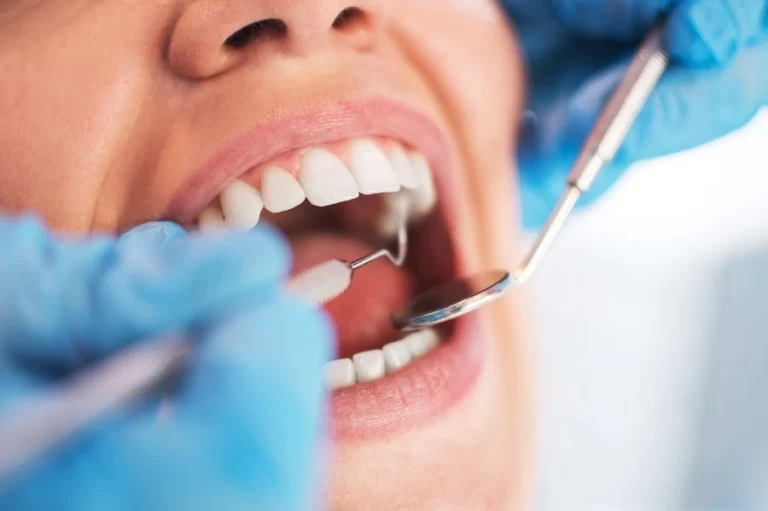 mejores dentistas recomendados en cordoba